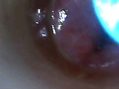 Einschiebung, Pov, Spanner