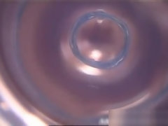 異人種間, 日本人, ティーン